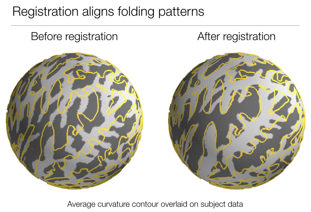 Sulcal patterns