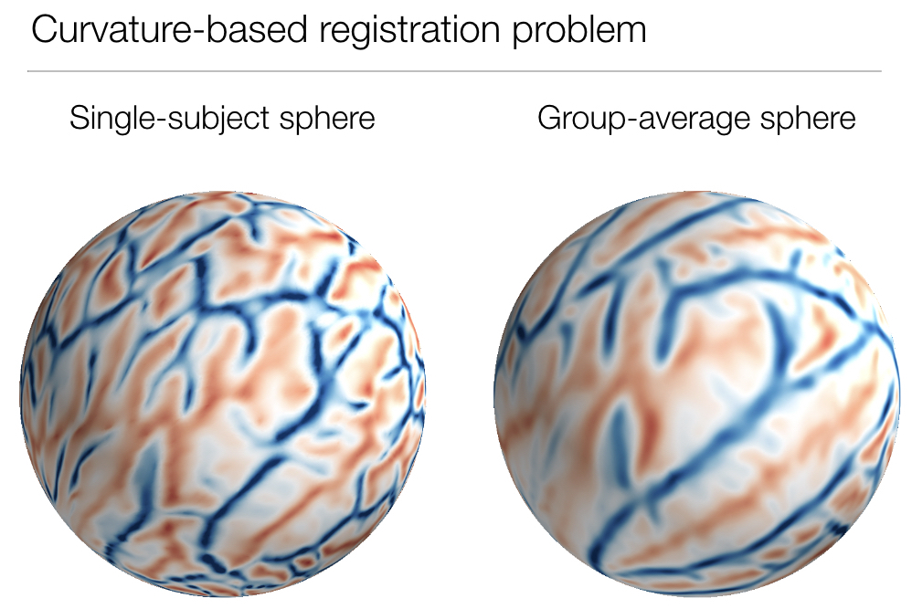 Curvature based